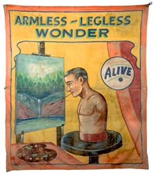 Armless—Legless Wonder.