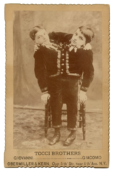 Tocci Brothers Siamese Twins Cabinet Card.