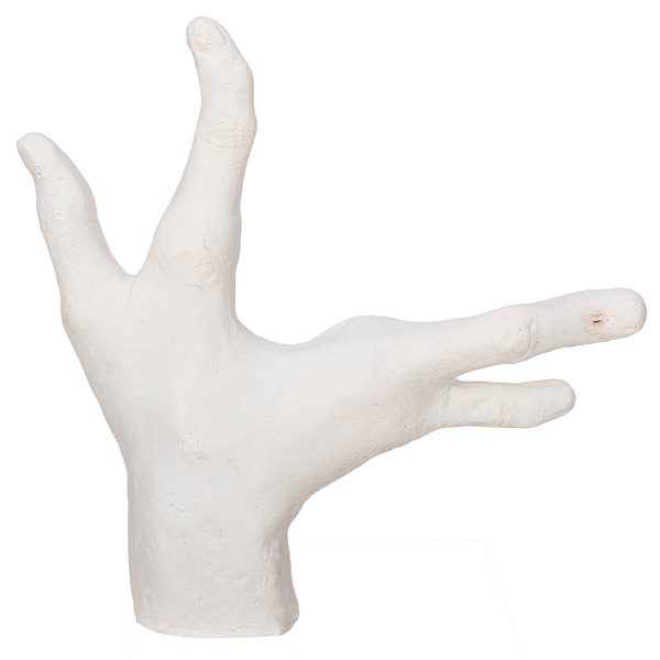 Life Size Plaster Cast of Lobster Boy’s Hand.