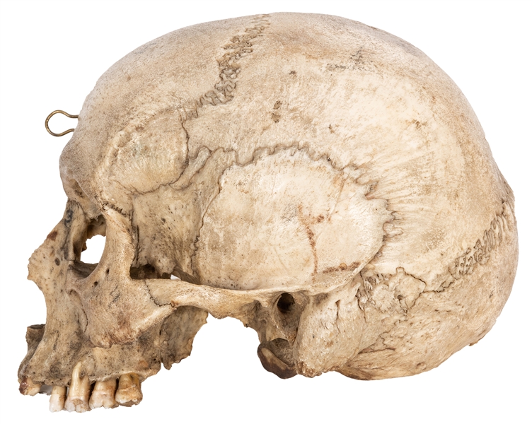 Half Human Skull.