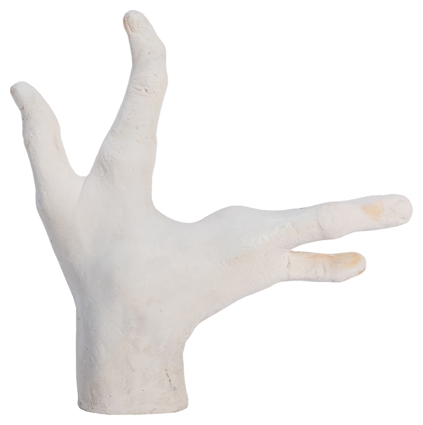 Life Size Plaster Cast of Lobster Boy’s Hand.