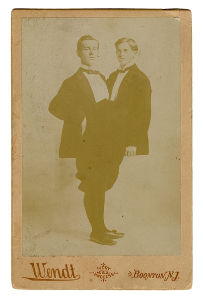 Adolph-Rudolph Siamese Twins Cabinet Card.