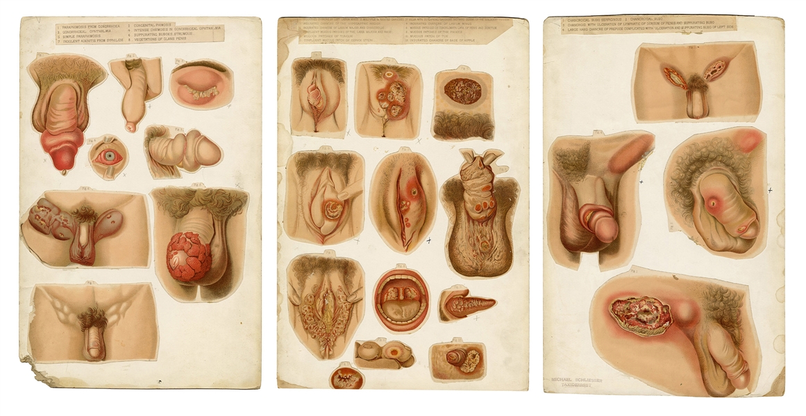 Group of Anatomical Wax Museum Catalogues, Ad Card, and Display Panels.