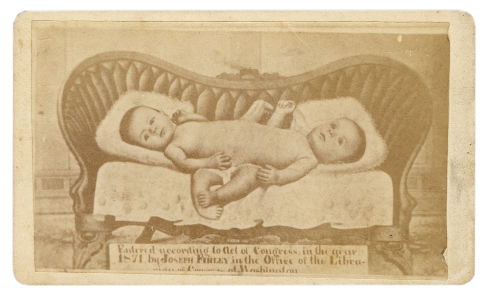 Mina and Minnie Finley Conjoined Twins CDV.