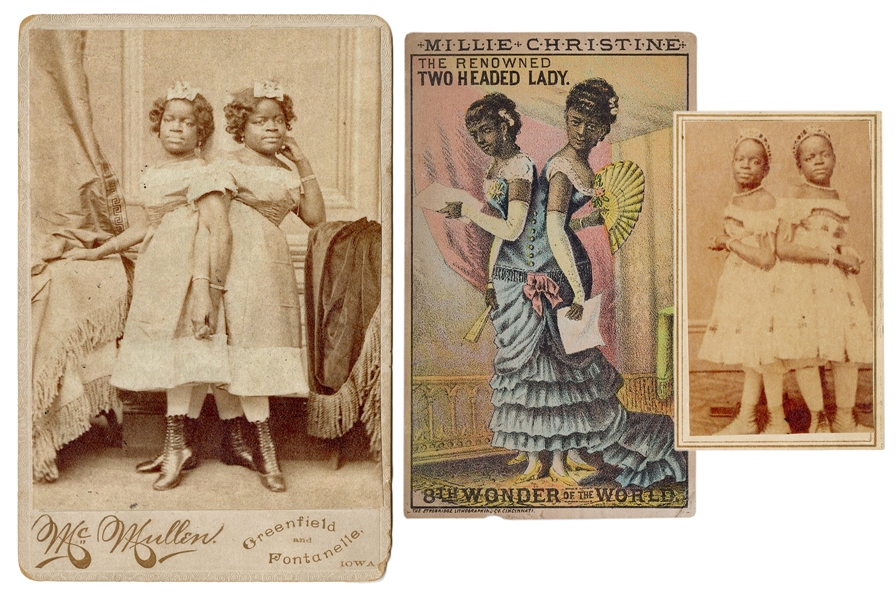  Millie-Christine Advertising Card. The Renowned Two Headed ...