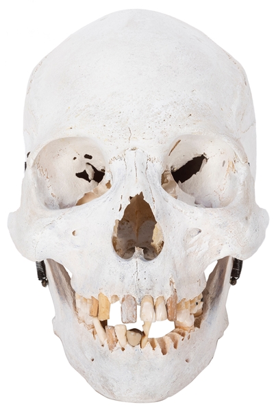  Articulated Human Skull. 25 teeth present; several wooden, ...