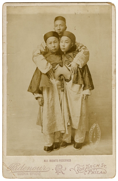  Cabinet Photo of Korean Siamese Twins. Philadelphia: Rideno...