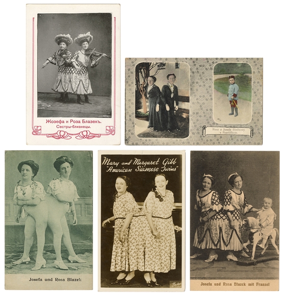  Five Postcards of Siamese Twins. Circa 1900s. Including fou...