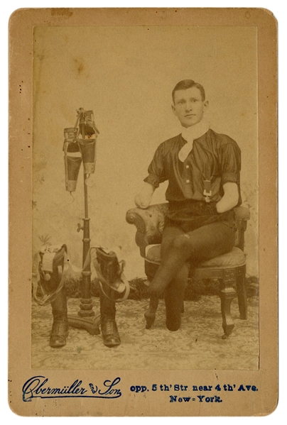  Cabinet Photo of a Man Posing with Prosthetic Arms and Legs...