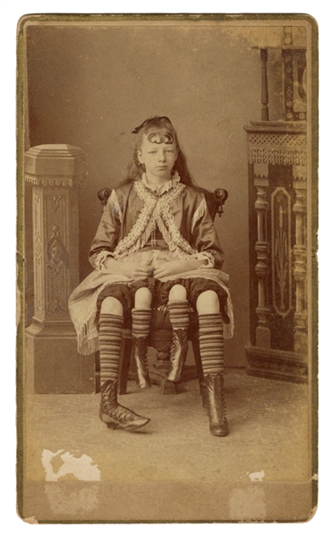  CDV of Myrtle Corbin, Four-Legged Girl. New York: Charles E...