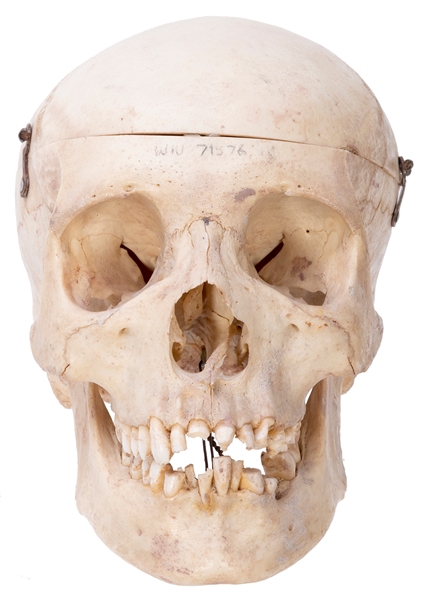  Anatomical Human Skull. Circa 19th/20th century. Detachable...
