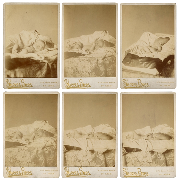  [MEDICAL ODDITIES]. Six Photographs of an Infant with a Mis...