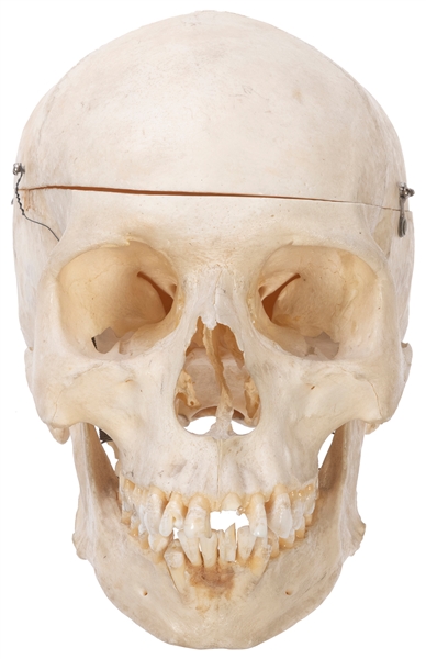  Human Skull with Articulated Jaw. Circa 20th century. Detac...