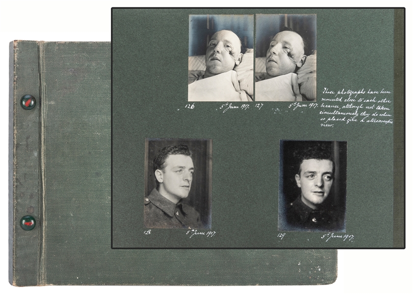  [ABNORMALITIES]. An album of 130 gruesome WWI photographs o...