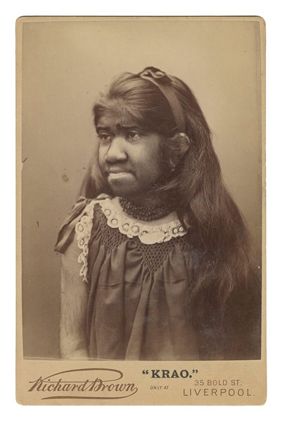  [FARINI, Krao (1876–1926)]. Cabinet Card Portrait. Liverpoo...