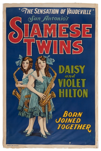  Siamese Twins Daisy and Violet Hilton. Kansas City, MO: Qui...