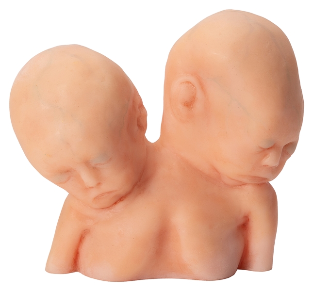  Medical Wax Two Headed Baby. 1970s. Wax casting of a two he...