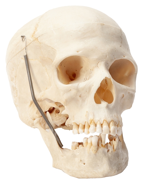  Medical human skull and partial skeleton. Carolina Biologic...