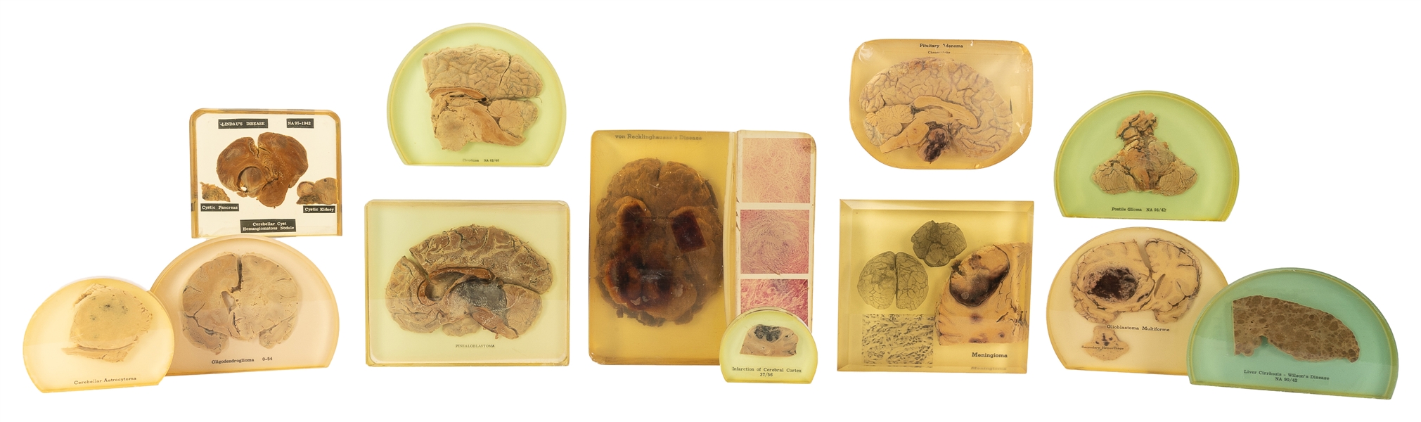  [MEDICAL SPECIMENS]. Group of Brain Medical Specimens. Acry...