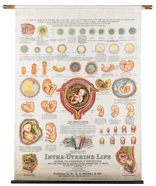  Intra-Uterine Life Chart. Cleveland: Otis Lithograph Co., 1...