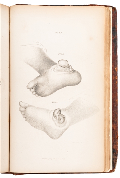  COOPER, Astley (1768-1841). A Treatise of Dislocations and ...