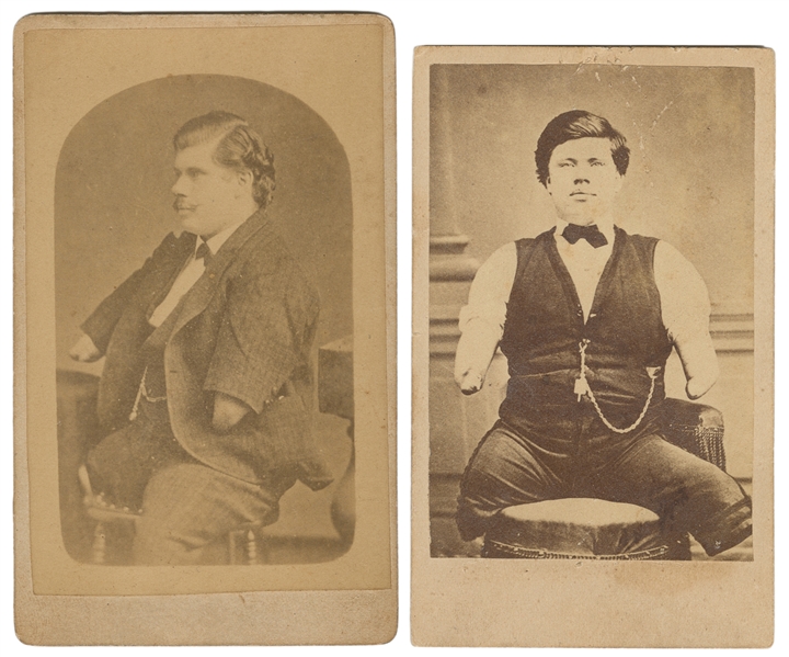 Two Photos of Walter H. Stuart, Limbless Sideshow Performer...