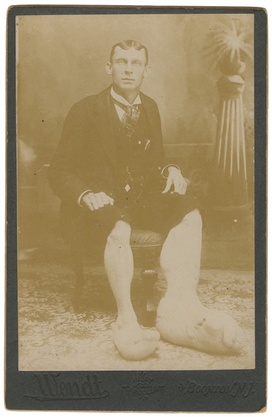 Eugene Berry, “Ohio Big Foot Boy" Cabinet Photo. Boonton, N...