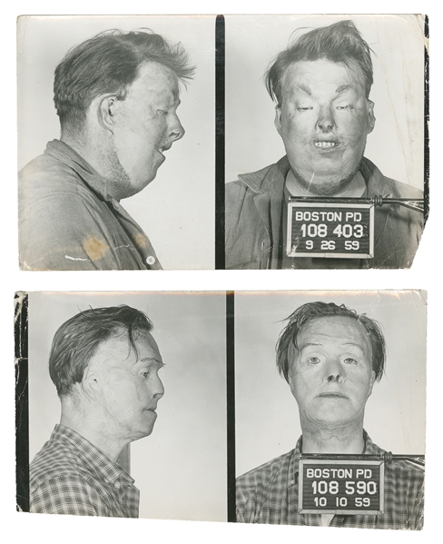 [MUGSHOTS]. Two Mugshots of Burn Victims. 1959. Two mugshot...