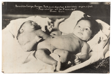  Siamese Twins Sideshow Lobby Board. Circa 1930s-40s. Photog...