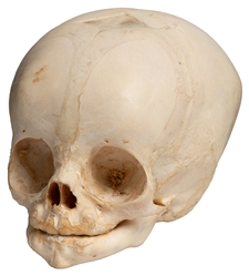  Human Fetal Skull. 20th century. Specimen of a full-term sk...