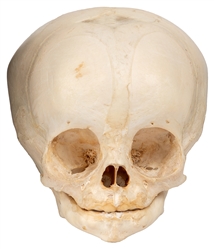  Human Fetal Skull. 20th century. Specimen of a full-term sk...